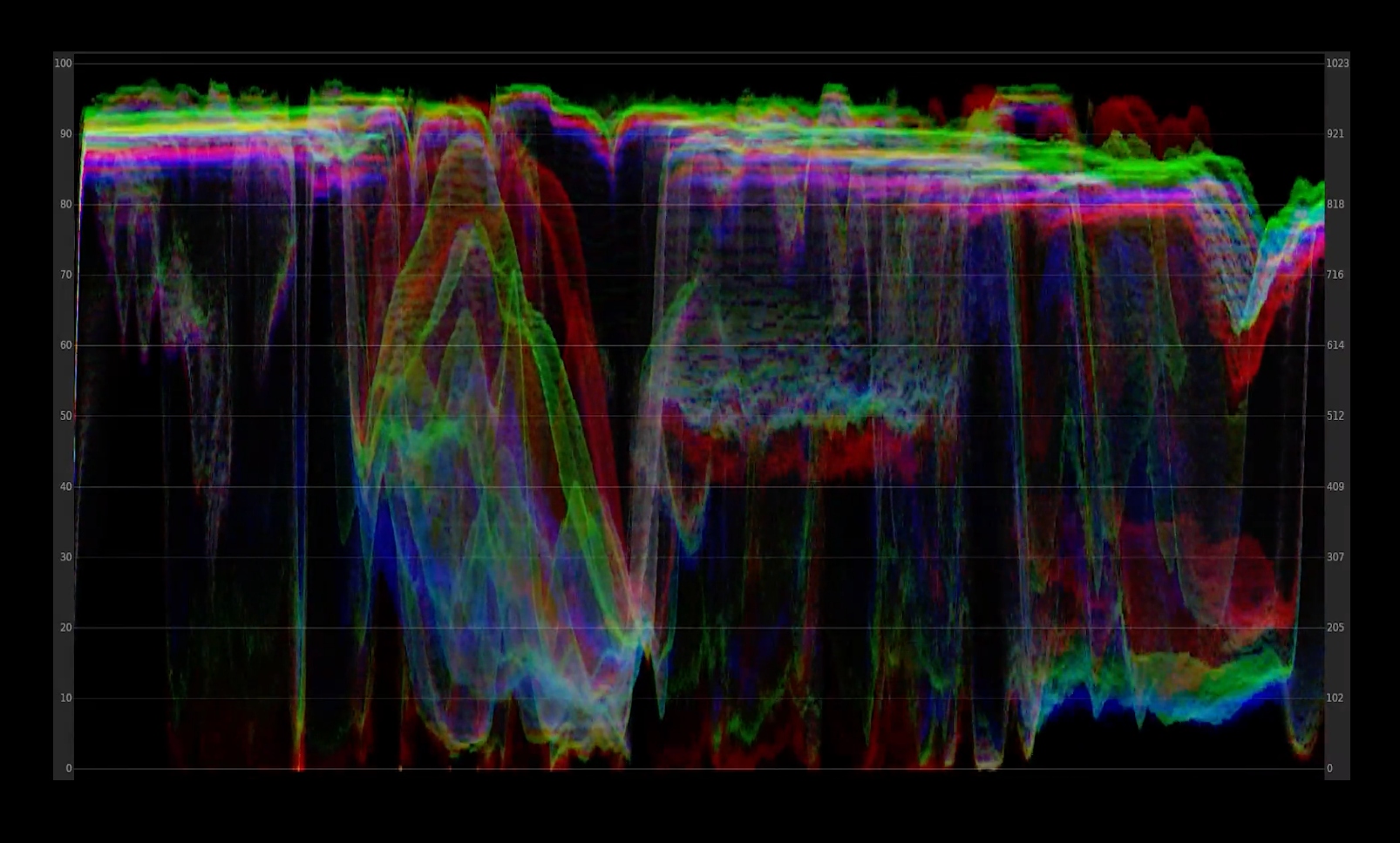 tachycardia