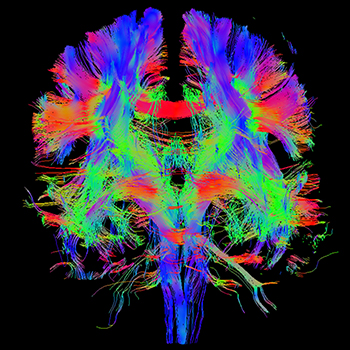 Sixth Annual photo contest Brain Fibers