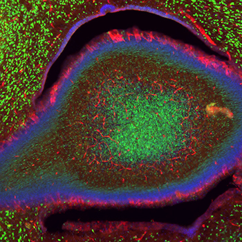 Sixth Annual photo contest Eye of the Cerebellum