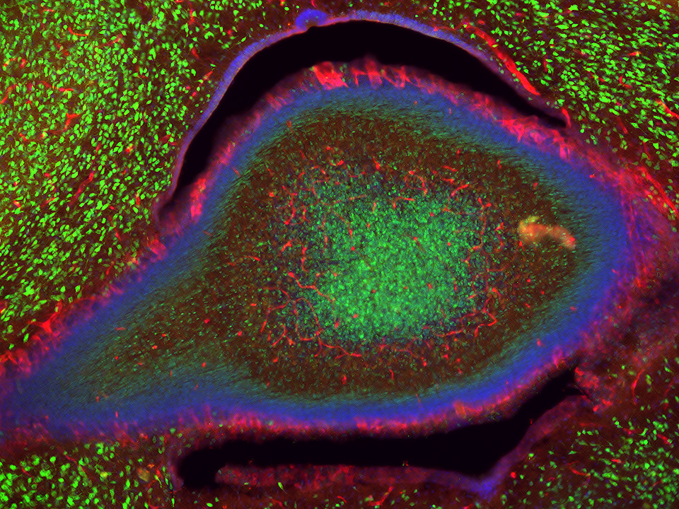 2024 photo contest Eye of the Cerebellum	