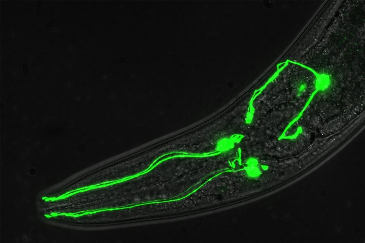 Dopamine-Linked Brain Disorders