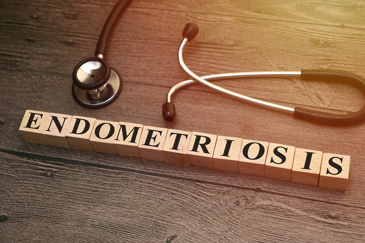 Tools for Early Diagnosis of Endometriosis