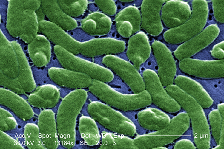 "Flesh-Eating" Bacteria Causing Infections?