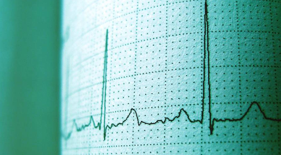 EKG 12 Leads September 11th - October 16th, 2024